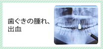 歯ぐきの腫れ、出血